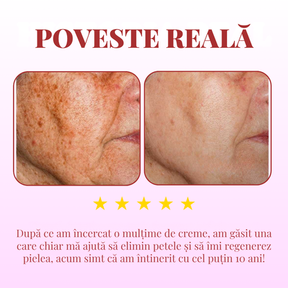 DragoCream | Aceeași piele, dar cu 10 ani mai tânără! | 2x2 doar astăzi