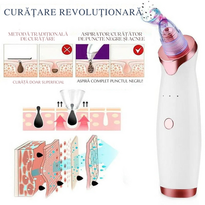Extractor de acnee – Curățare Eficientă și Fără Durere